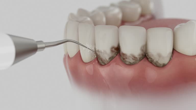 Reliable Dental Implants contractor in Brookfield, IL by Smile Center Dentistry